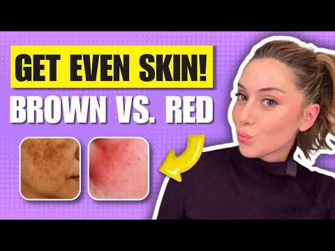 Dark spots and redness: a practical tone-evening guide
